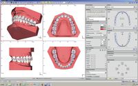 OnyxCeph³™ module V.T.O.3D (Virtual Treatment Objective)