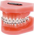 Modelo de ortodoncia para demostraciones discovery® sl