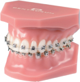 Modelo de ortodoncia para demostraciones discovery® sl 2.0