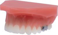 Modelo de ortodoncia para demostraciones tomas® / amda®