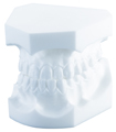 Orthodontic study model, Angle Class III